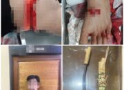 Melukai Tiga Orang Dengan Sajam, Polres Melawi Amankan LR Alias UW